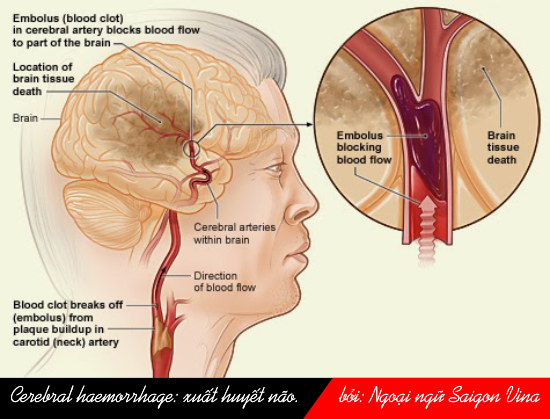 Cerebrum