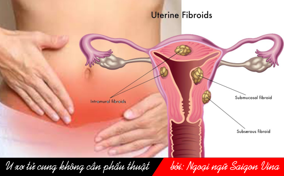 fibroblast